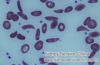 Chronic Kidney Failure and Sickle Cell Disease