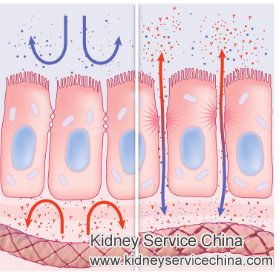 Is Hypoproteinemia Curable for Kidney Patients