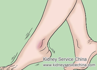 Swelling in Legs and Face with Diabetic Nephropathy