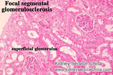 FSGS and Kidney Transplant Outcome