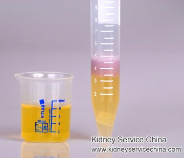 How Long Will Hematuria Last With IgA Nephropathy