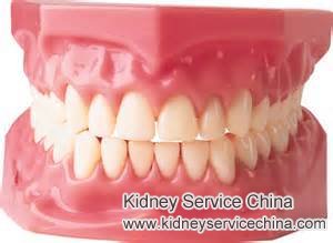 IgA Nephropathy and Swollen Gums