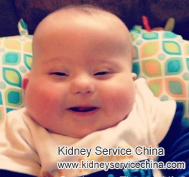 Moon Face in IgA Nephropathy