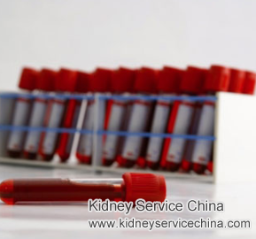 Creatinine 15.7 and Uric Acid 11.4 for Diabetic Nephropathy