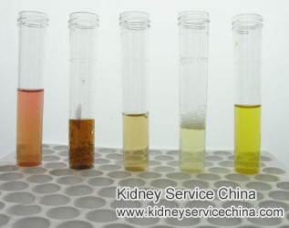 Repeated Cases of Blood In Urine with IgA Nephropathy