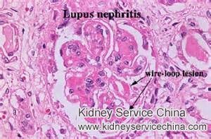 How Can I Restore Kidney function with Lupus Nephritis
