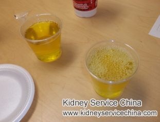 Is It Bad That FSGS Patients Have A Lot of Bubbles in Urine