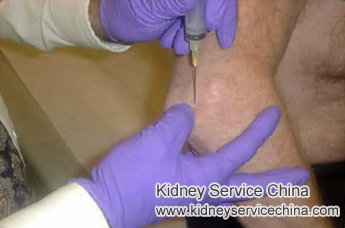 Home Remedies to Treat Gout with FSGS