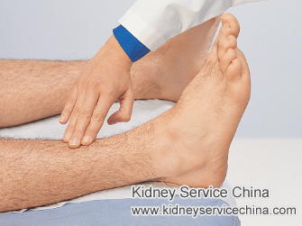 Edema and Diabetic Nephropathy