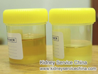 Can You Have Lupus Nephritis With No Protein in Urine