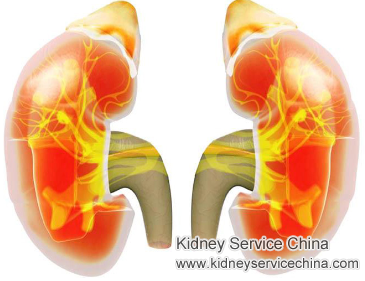 How to Be Safe for SLE at Stage 4 with Nephrotic Syndrome