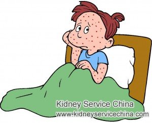 Itchy Skin Rash Doesn't Go Away for IgA Nephropathy Patients