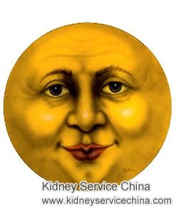 Moonface for Nephrotic Syndrome Patients