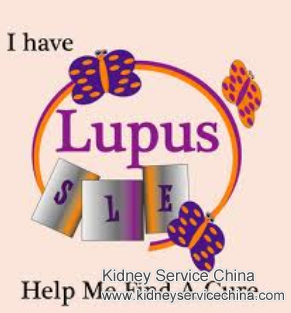 High Uric Acid for Systemic Lupus Erythematosus