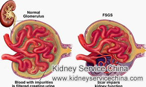How to Reverse FSGS Kidney Disease