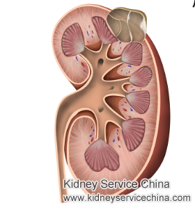 Treatment for Complex Renal Cyst in Upper Pole of Left Kidney