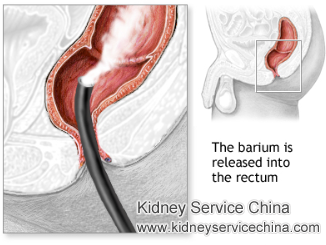 Enema Therapy to Lower High Creatinine 8.94