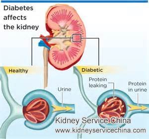 A Diabetic with High Blood Pressure and Creatinine 6.4
