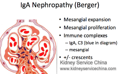 How to Reverse IgA Glomerulonephritis Naturally