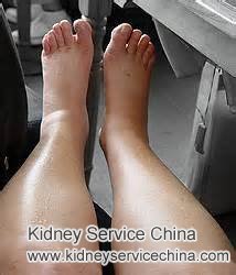 How to Manage Swelling in Legs for Nephrotic Syndrome Patients