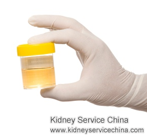 Kidneys Leak A Lot of Protein: How Do I Stop It