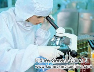 IgA Nephropathy with 37% Kidney Efficiency: Is Immunotherapy Useful