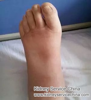 Chinese Medicines’ Efficiency: Only a Real-world Trial Can Tell 