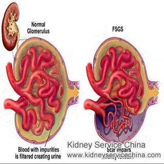 The Proper Treatment for FSGS( Focal Segmental Glomerulosclerosis)