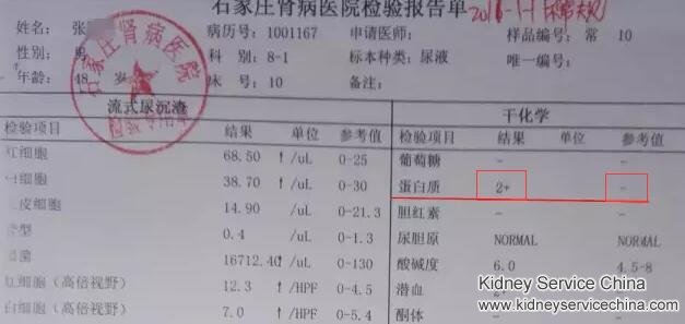 Urine Protein 4.37g Decreased to Normal Level with Chinese Medicine