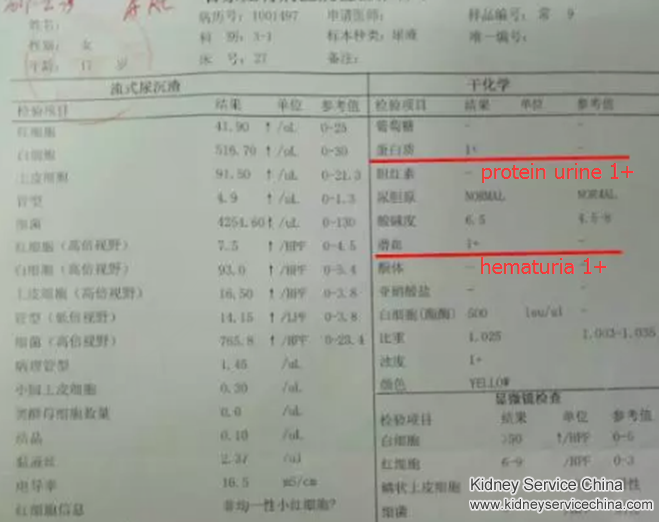 Both Brother and Sister are Lupus Nephritis, Is There A Way to Save Them