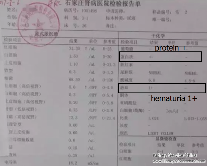 Both Brother and Sister are Lupus Nephritis, Is There A Way to Save Them
