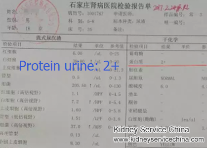 Protein Urine2+ Turned to Negative in NS with Natural Treatment