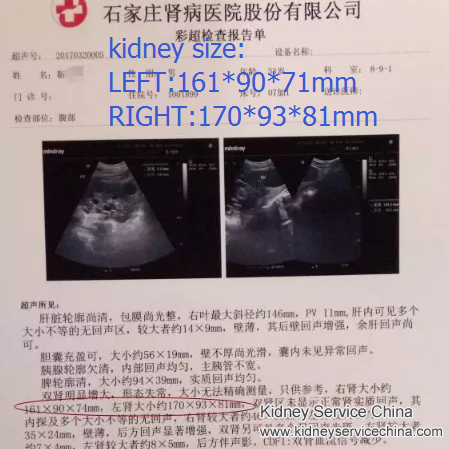 Shrink Kidney Size 4cm with Natural Treatment within a Month