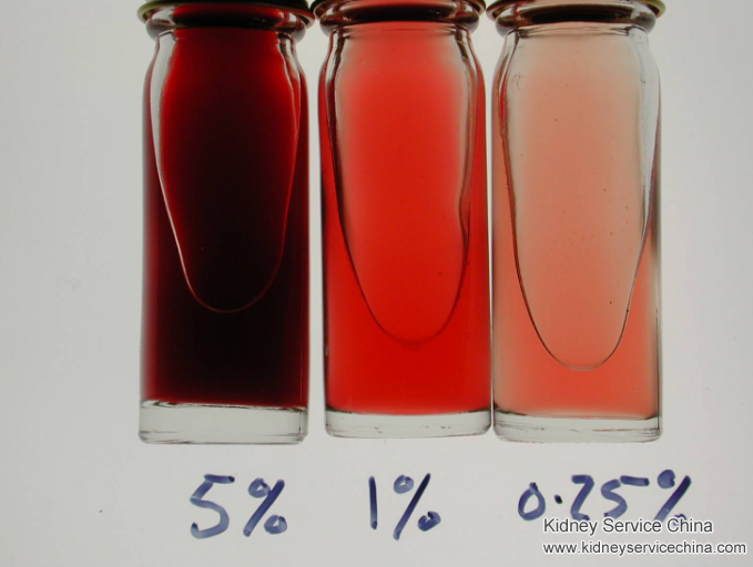 Occult +++in Nephritic Syndrome Be Improved with Natural Treatment