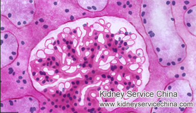 Is Tea Colored Urine Serious in IgA Nephropathy