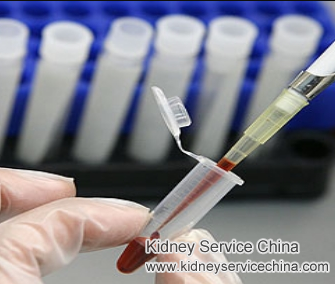 Lower High Creatinine Level 7.68 with Natural Treatment in Hypertensive Nephropathy