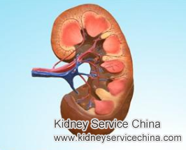 How to Deal With GFR 16% in CKD with Natural Treatment