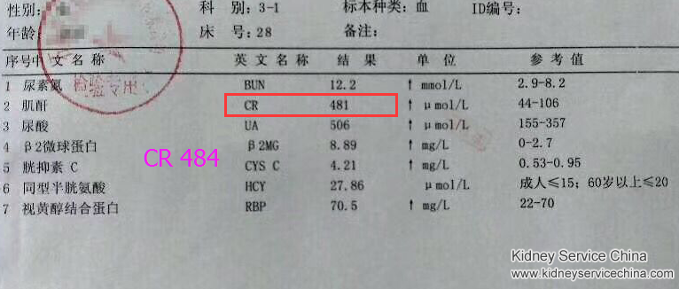 Toxin-Removing Treatment Treats Kidney Shrinkage Effectively