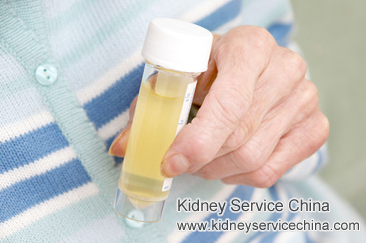 What Is The Effective Treatment for Refractory Hematuria In IgA Nephropathy
