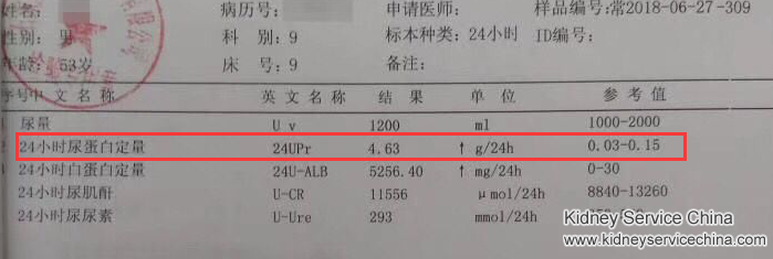Urine Protein Turns Negative In Nephrotic Syndrome